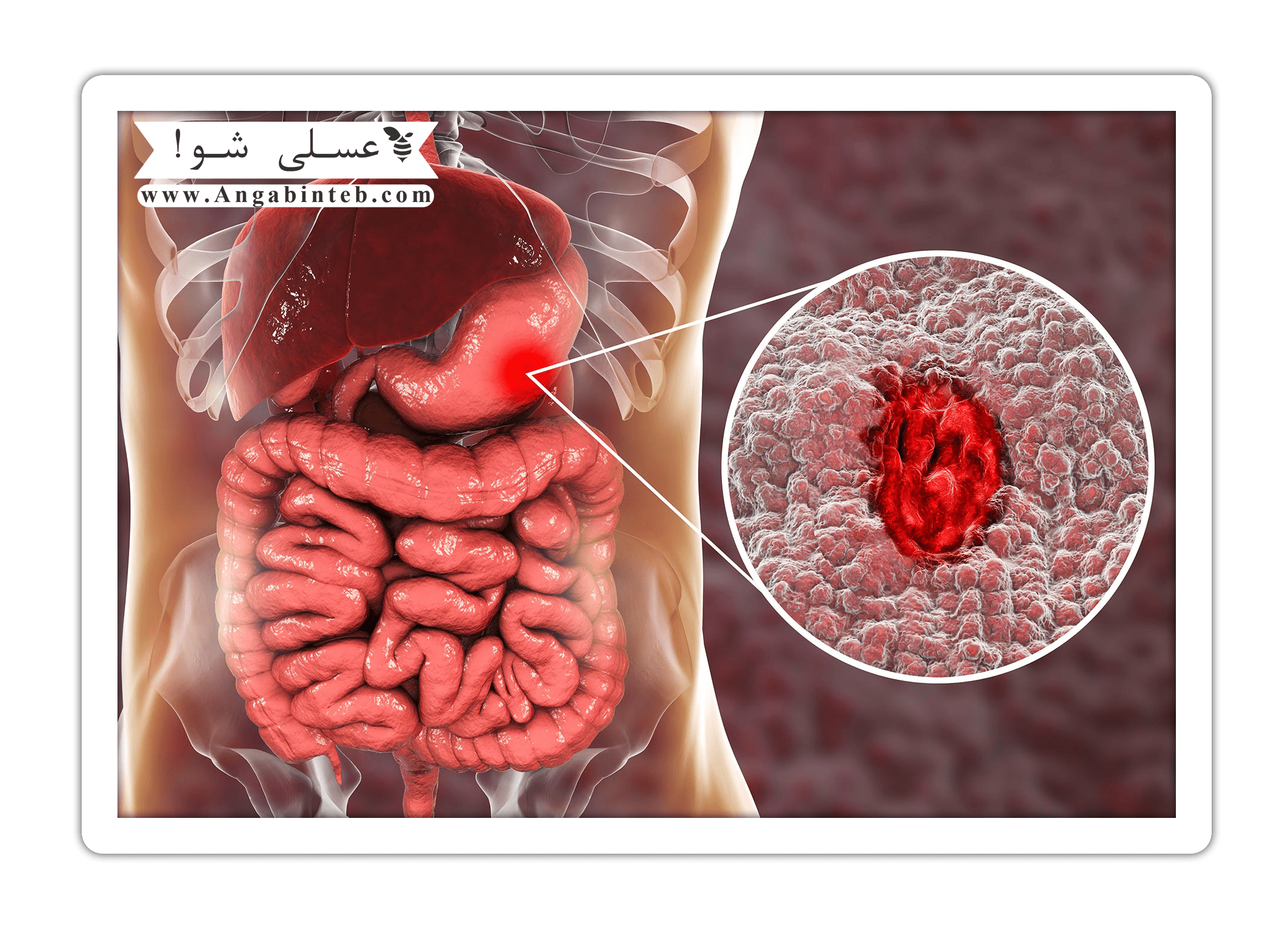 Diet and physical consequences-1-min